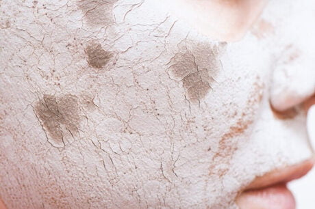 Causes of dryness and roughness of the face